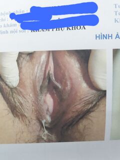 Em gái đi khám phụ khoa
